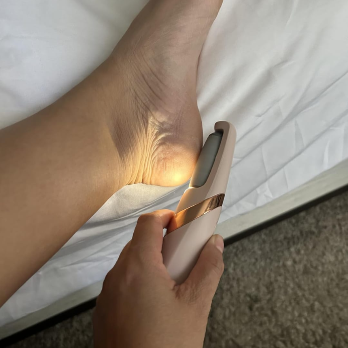 Kivara Callus Remover