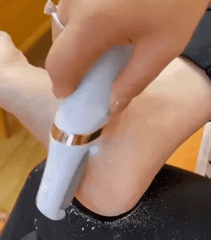 Kivara Callus Remover