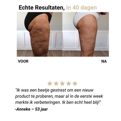 Selena® – Anti-Cellulite Massager voor Gladde Huid