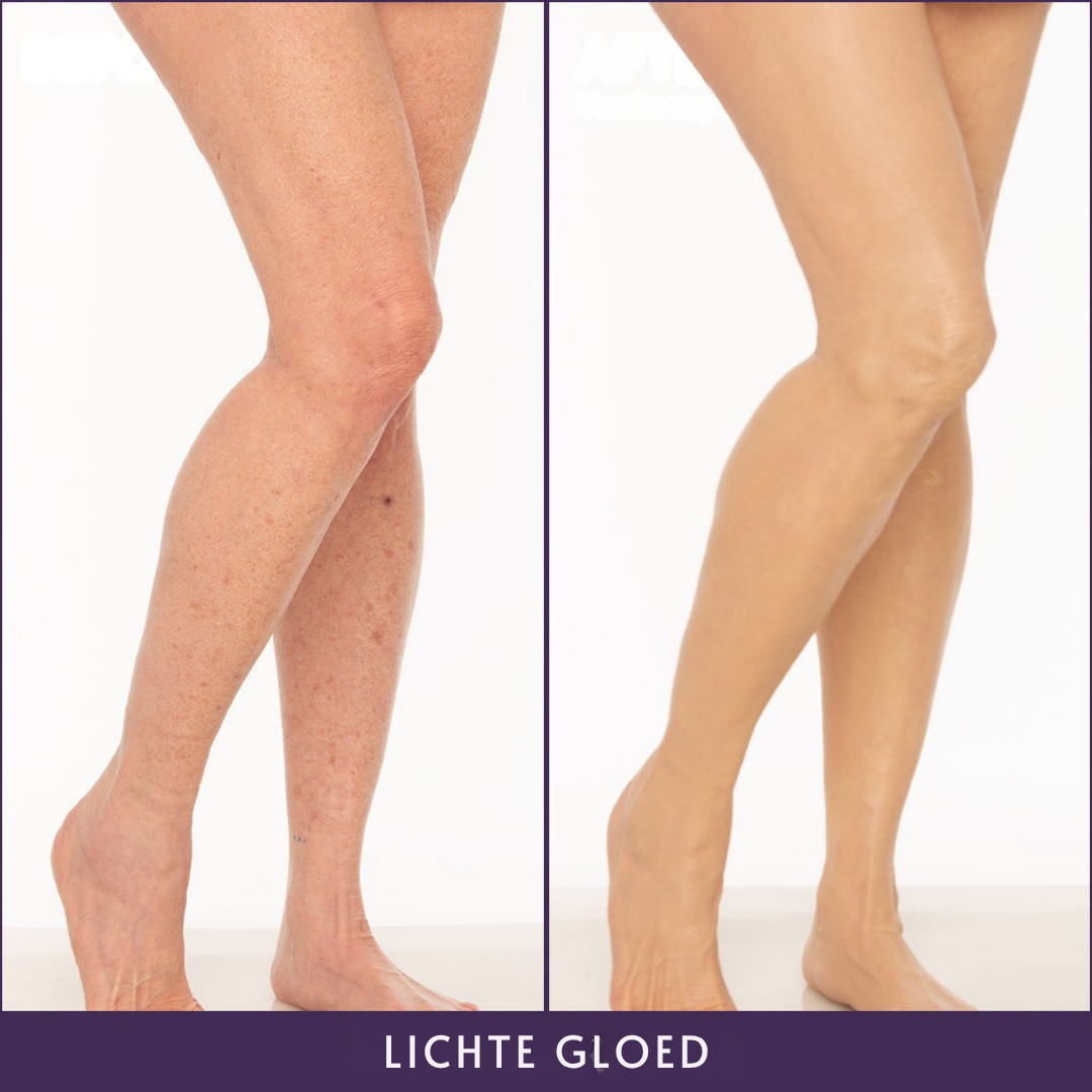 Veloris Lichaamperfector™ - Foundation voor een egale huid