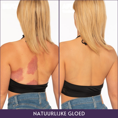 Veloris Lichaamperfector™ - Foundation voor een egale huid