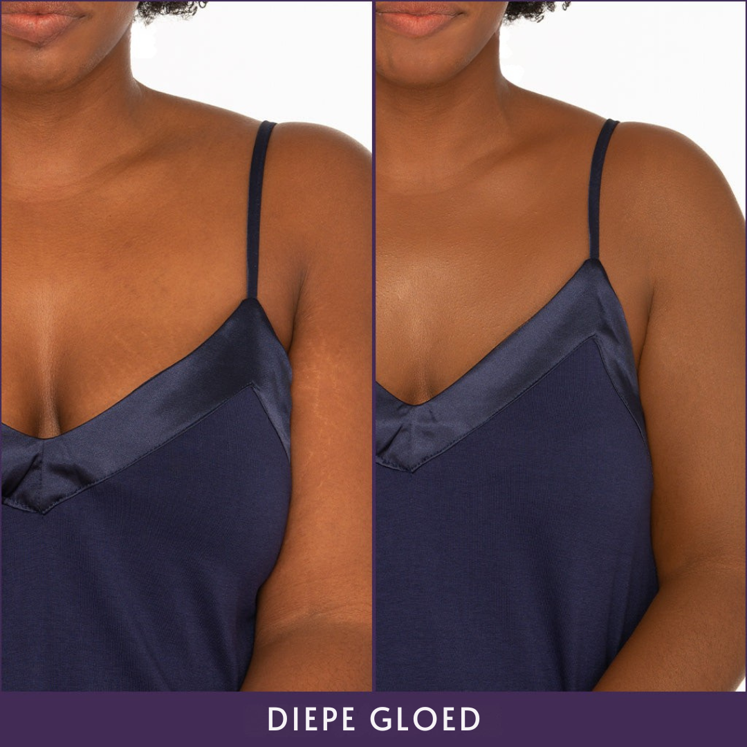 Veloris Lichaamperfector™ - Foundation voor een egale huid